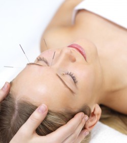 acupuncture