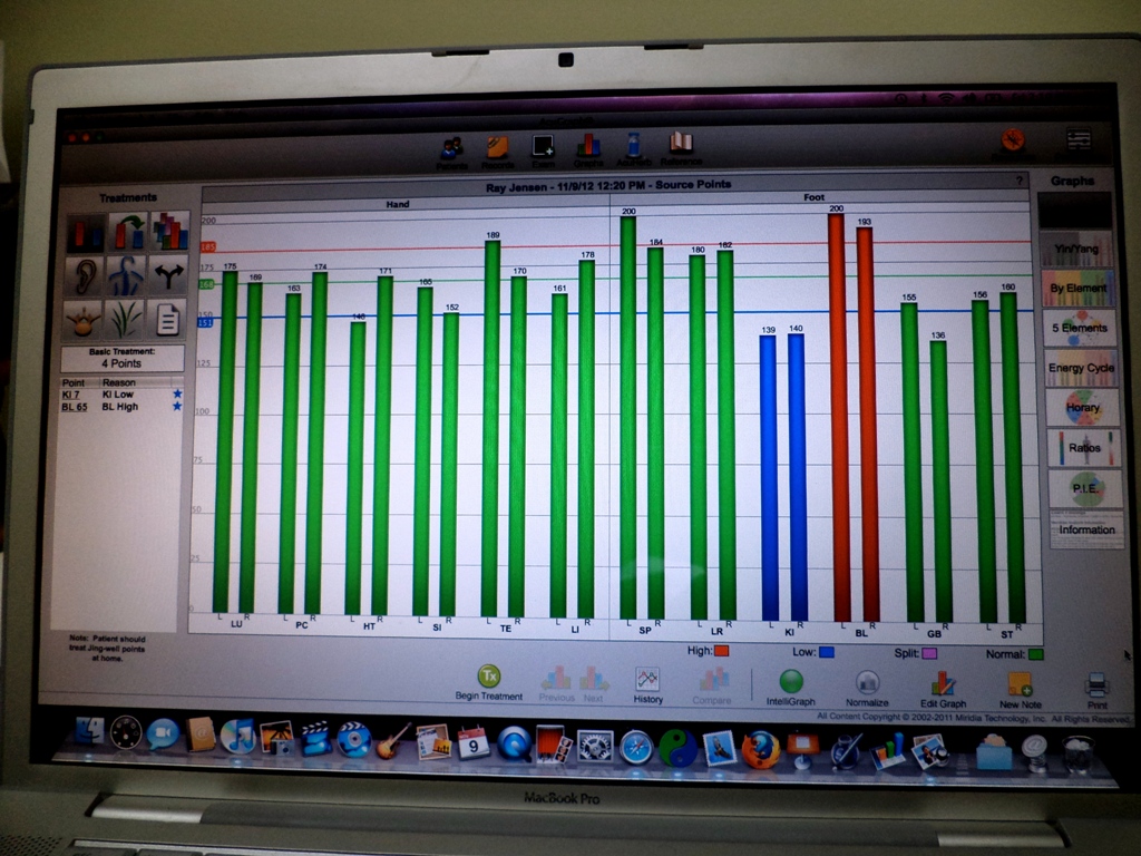 Acupuncture: Balance Your Energy, Balance Your Life - Clinic of ...